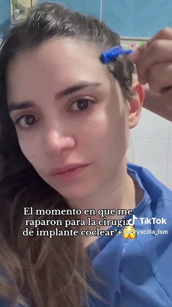 Rapar para cirugía de implante coclear: mi experiencia