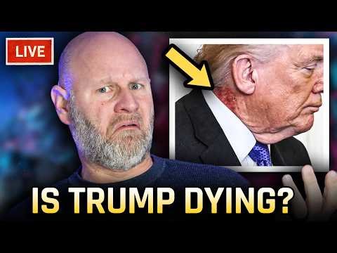 Visibly Dying Trump Terrifies Onlookers With Disgusting New Ailment