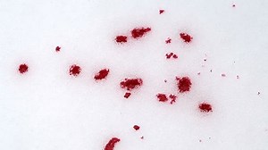 Blood Drops Snow Stock Footage Video (100% Royalty-free) 4108153 | Shutterstock