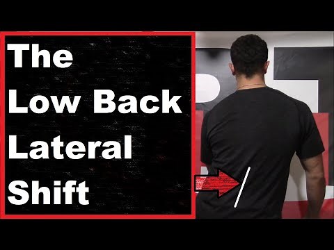 Low Back Pain: The Lateral Shift