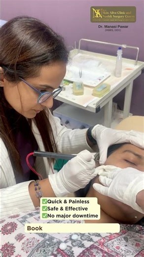 DPN Removal with RF | Dr. Manasi Pawar | Bliss by Skin Alive Clinic & Nashik Surgery Centre
