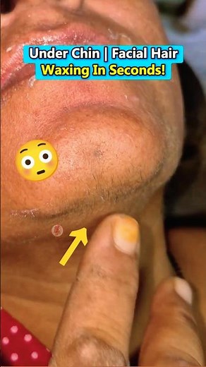 Under Chin Waxing | Facial Hair Removed Instantly ✨#chinhair