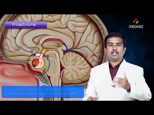Prolactinoma Pathology USMLE Step 1 - Quick review