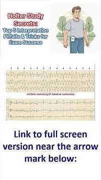 Holter Study Secrets: Top 5 Interpretation Pitfalls & Tricks for Exam Success