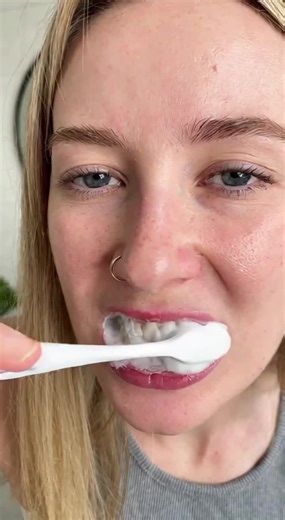 Blanqueamiento Dental en 7 Días: Resultados Rápidos