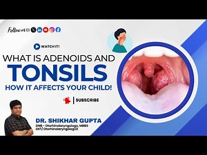 Discover What Is Adenoids and Tonsil and How It Affects Your Child! | By Dr. Shikhar Gupta #ENT