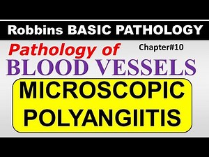 Ch10 | MICROSCOPIC POLYANGIITIS | Blood Vessel Pathology | Robbins Lectures