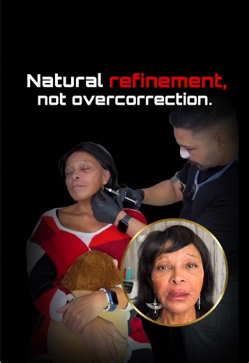 In this video, you can see our client during her treatment journey — smooth, precise, and tailored entirely to her facial structure. We enhanced the jawline, chin, nose, cheeks & tear troughs, restoring balance and freshness while keeping everything beautifully natural. Her treatment is progressing perfectly… and she’s already loving the results 💉✨ 📍 Deep Aesthetics Clinic, London 📞 Clinic: 44 7476 559188 📱 Kiran: 44 7496 408112 📅 calendly.com/deepaesthetics 🌐 DeepAesthetics.co.uk 📧 info@