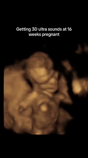 Why she lookin like an alien 😂💖 #fyp #pregnancyjourney #pregnant #16weekspregnant #whatthe #babygirl #ultrasound #baby #babynumber2 #greenscreen #pregnanttiktok