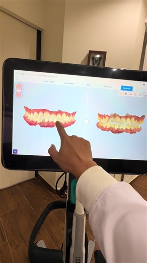 Life changing #itero #invisalign @icaredentaldh