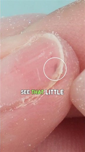 WHAT Causes THESE?!😳