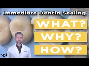 Immediate Dentin Sealing | What, Why, and How to Perform • Video • MEDtube.net