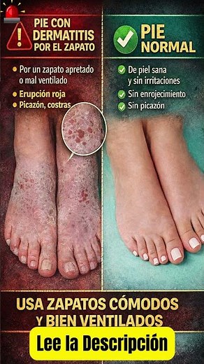SIGNOS DE UN PIE ENFERMO