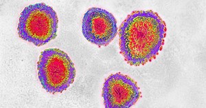 CDC confirms 5th case of new coronavirus in U.S.