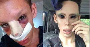 Vinny Ohh va en busca de más operaciones para parecer extraterrestre