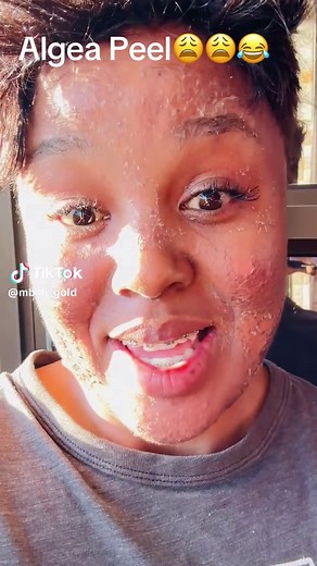 Understanding Algae Peel Benefits for Skin Care