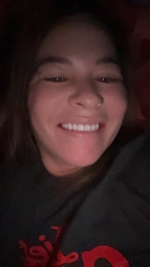 Understanding Immediate Dentures for Young Adults