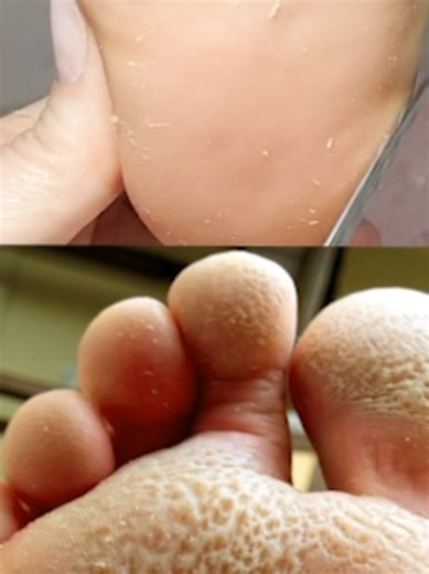 Understanding Foot Odor and Health Issues