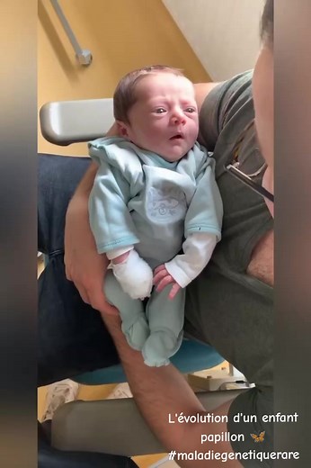 Évolution d'un enfant papillon : À tes 5 ans, mon amour !