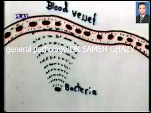 general pathology1 : inflammation 1: DR/SAMEH GHAZY