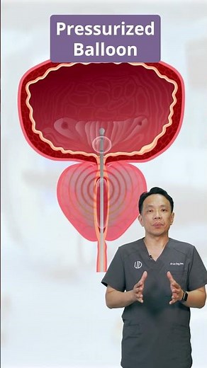 Prolieve - Thermodilatation Therapy (BPH treatment)