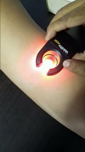 visualizador de Venas