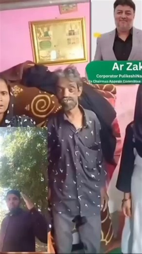 Ar Zakir on Instagram: "After I was informed about the health condition of young Yasmeen, who has been suffering from fibrous dysplasia since 2003, through a social influencer who approached me seeking help, I personally ensured that she was taken to well-known and experienced doctors. She was referred to senior surgeons Dr. Krishnamurthy and Dr. Dipesh Rao from Jain Hospital, who have carefully consulted her and initiated the necessary treatment and ensured full support through smile foundation