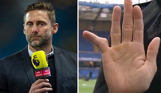 Pics: Ex-Premier League stopper Rob Green explains how he mangled his little finger in goals - Extra.ie