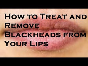 How to Treat and Remove Blackheads from Lips