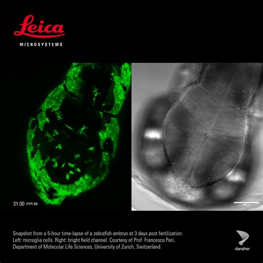 Read our new application note and discover long-term live imaging of complex 3D samples with the Viventis light sheet microscope. Discover effective strategies to reduce phototoxicity and preserve sample integrity during extended imaging sessions ➡️ https://fcld.ly/jl72r4h These advanced features of Viventis Deep for high-resolution, long-term imaging of 3D multicellular models such as organoids, spheroids, and embryos open new avenues in developmental biology and disease research. Video: Snapsh
