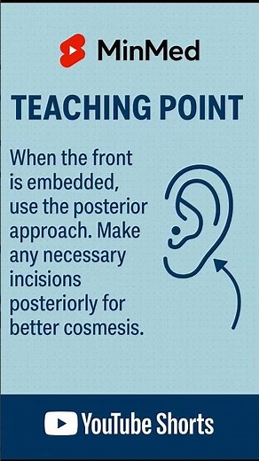 Embedded earring 👂🏽 Use posterior approach for cosmetic removal ✂️✨
