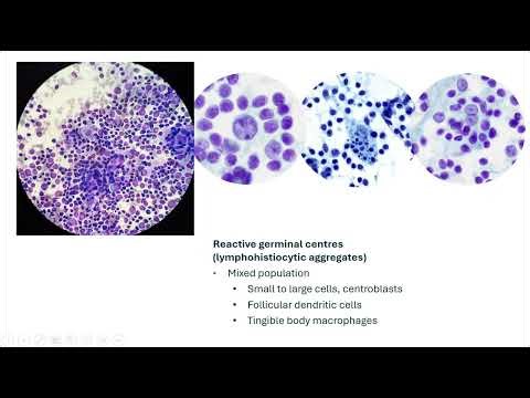 Pathweb Cytopathology Quiz: Lymph Node Cytology 1.1 (BASIC level quiz 1)