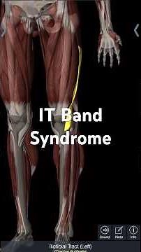 IT Band Syndrome by Physio