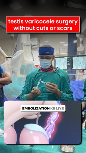 Varicocele Angiography and Embolization at Half the Cost #shorts
