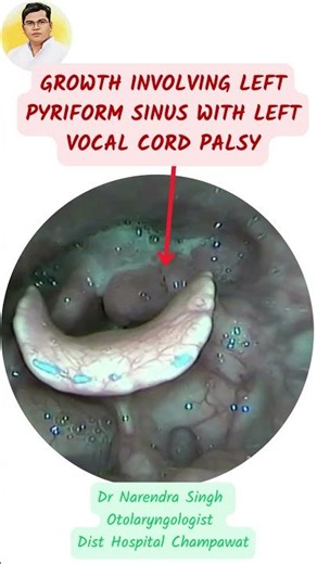 SUDDENLY PATINET VOICE 🎤 CHANGED DUE TO SUSPICIOUS REASON