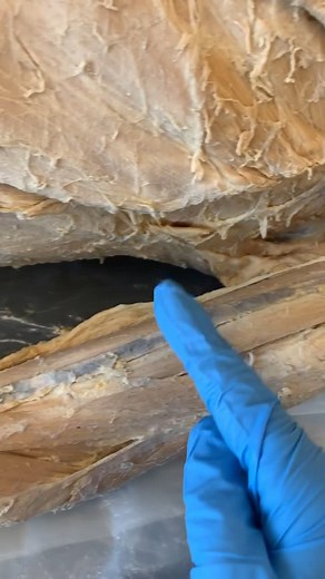 60,000 MILES (100,000 KM)!! This is just the best approximation. #sciencetrivia #sciencefacts #randomfacts #scienceiscool