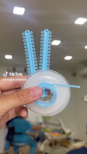 Exploring Baby Blue Dental Braces for a Bright Smile