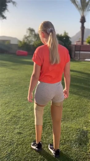 98K views · 10K reactions | The biggest adventure you can ever take is to live the life of your dreams..露樂 #amputee #cartwheel #prosthetics #fyp #explorepage #disability | Daisy-May Demetre | Facebook