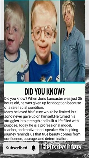 Jono Lancaster’s Incredible Story | Abandoned at Birth, Inspiring Millions Today!!