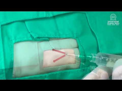 Técnica de colocación análise e incisión