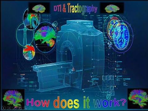 04. Brain DTI & Tractography (1) ... Prof. Dr. Rania Essameldein Mohamed