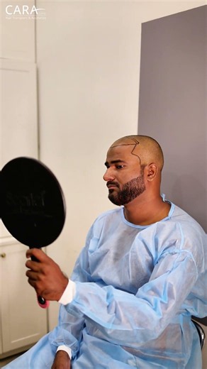 From Bald to Bold: Hair Transplant Design Process
