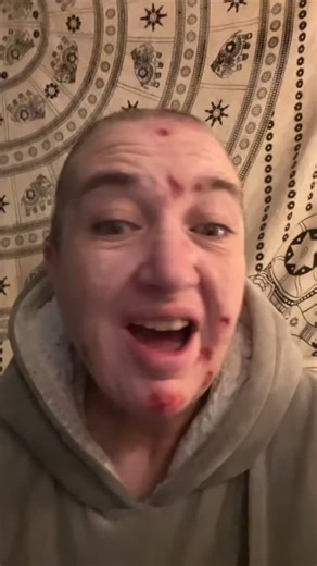 You Hate Me | I have seen this dream before Let me walk you through it It's evening time and the woods call A cop tells us we can't go at night We... | Instagram