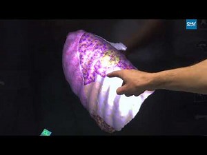 La chirurgie robotique assistée par l'image