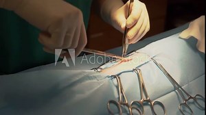 performing a surgical procedure using a tool such as a scalpel, clamps, scissors, disinfection and bandages. traces of blood