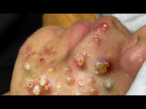 𝑺𝒐𝒐𝒕𝒉𝒊𝒏𝒈 𝑭𝒂𝒄𝒊𝒂𝒍 𝑻𝒓𝒆𝒂𝒕𝒎𝒆𝒏𝒕 𝒇𝒐𝒓 𝑺𝒕𝒓𝒆𝒔𝒔 𝑹𝒆𝒍𝒊𝒆𝒇 | 𝑫𝒆𝒆𝒑 𝑪𝒍𝒆𝒂𝒏𝒊𝒏𝒈 & 𝑪𝒂𝒍𝒎𝒊𝒏𝒈 𝑴𝒂𝒔𝒔𝒂𝒈𝒆 𝒂𝒕 𝑳𝒖𝒙𝒖𝒓𝒚 𝑺𝒑𝒂 #887548