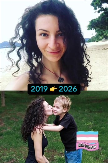 4 года на гормональной терапии тестостероном #трансгендер #трансгендерныйпереход #транспереход #небинарный #сменапола
