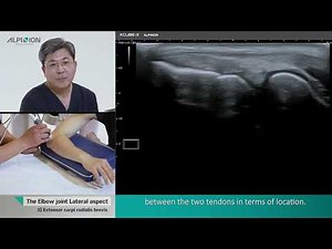 Musculoskeletal Ultrasound (Elbow) 03.Lateral aspect
