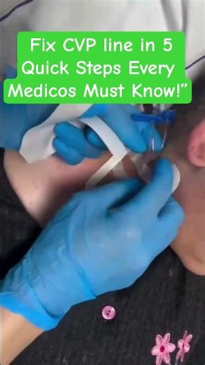 “Quick Guide to Fix a CVP Line in ICU”#‪@SmartMedicalKnowledge‬ #icu