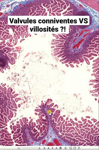 Intestin grêle, valvule connivente ou villosité ?! #shorts #histology #histologie